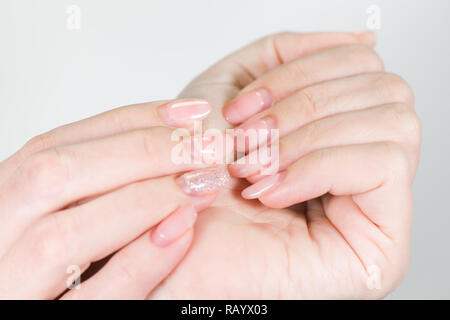 Nahaufnahme von zwei weiblichen weißen Hände mit alten Gel poliert Maniküre benötigen Korrektur nach mehreren Wochen tragen. Vertikale Farbfotografie. Stockfoto