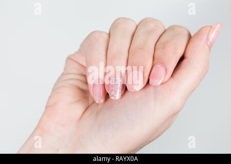 Nahaufnahme des 1 Weibliche weiße Hand mit alten Gel poliert Maniküre benötigen Korrektur nach mehreren Wochen tragen. Horizontale Farbfotografie. Stockfoto