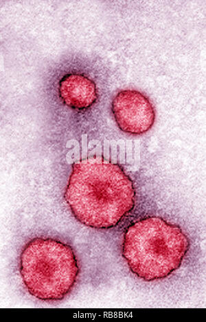 MUMPS VIRUS TEM Stockfoto