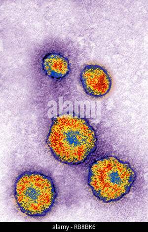 MUMPS VIRUS TEM Stockfoto