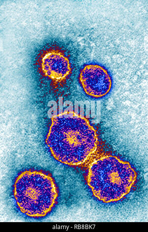 MUMPS VIRUS TEM Stockfoto