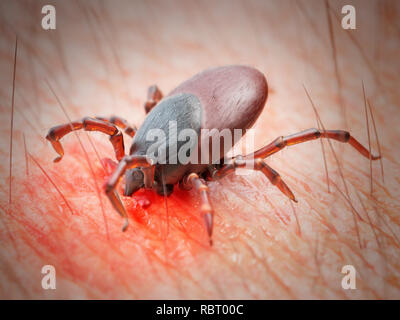 Abbildung: eine Zecke beißen die menschliche Haut. Stockfoto