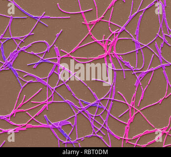 Milzbrandbazillen. Farbige Scanning Electron Micrograph (SEM) von Milzbrandbazillen. Anthrax ist eine schwere ansteckende Krankheit, die durch Gram-positive, Ro Stockfoto