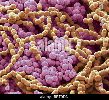 Sputum. Scanning Electron Micrograph (SEM) von einer bakteriellen Kultur aus Sputum. Schleim ist ein Sekret in die Atemwege während der Krankheit und der Entzündung. Ph Stockfoto