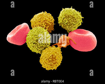 Blutzellen. Farbige Scanning Electron Micrograph (SEM) der menschlichen roten Blutkörperchen (Erythrozyten), weißen Blutkörperchen (Leukozyten, gelb) und Pla Stockfoto