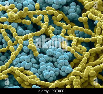 Sputum. Scanning Electron Micrograph (SEM) von einer bakteriellen Kultur aus Sputum. Schleim ist ein Sekret in die Atemwege während der Krankheit und der Entzündung. Ph Stockfoto