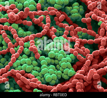 Sputum. Scanning Electron Micrograph (SEM) von einer bakteriellen Kultur aus Sputum. Schleim ist ein Sekret in die Atemwege während der Krankheit und der Entzündung. Ph Stockfoto