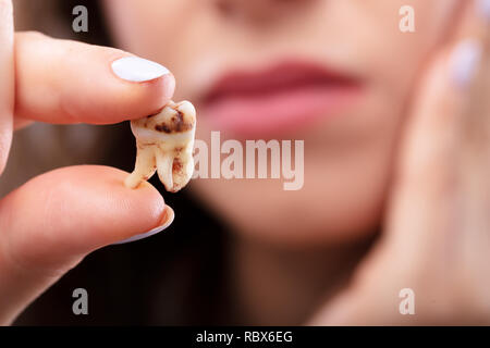 Nahaufnahme von einer Frau, die Hand, die Karies Zahn Stockfoto