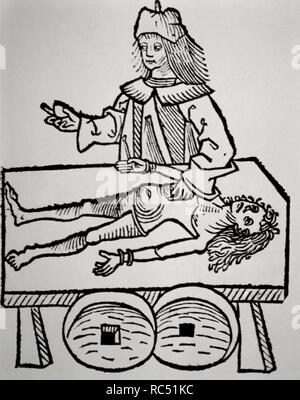 Medizinische Vorgeschichte. Arzt eine Berechnung der Gallenblase in Betrieb. Xilografia. Hortus Sanitatis von Johannes de Cuba (1430-1503). 15. JH. Stockfoto