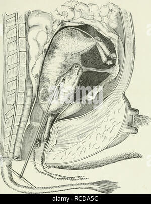 . Die Krankheiten und Störungen des Ochsen, mit Berücksichtigung der Krankheiten der Schafe. . Bitte beachten Sie, dass diese Bilder sind von der gescannten Seite Bilder, die digital für die Lesbarkeit verbessert haben mögen - Färbung und Aussehen dieser Abbildungen können nicht perfekt dem Original ähneln. extrahiert. Gresswell, George; Gresswell, Albert. London, Allen Stockfoto