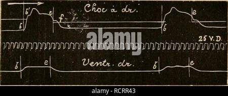 . Wörterbuch de Physiologie. Physiologie. 46^CARDIOGRAPHE, Le Plateau systolique s'allonge. (Voir la Abb. 13 de Roy et Adami, reproduite ici À la fÃ® g. 21.) Roy et Adami arrivent À la Abschluss assez Dekor courageante Â" qu'il est difficile et mÃªme datifi La plupart des Cas unmöglich de mesurer avec Genauigkeit la durÃ©e de diffÃ©rentes Phasen du Cycle cardiaque en s'en Mieter uniquement aux tracÃ© s du Choc du cÅur Â" (Roy et Adami, Ioc. A.a.o., 244). Eine HCrthle publiÃ© d'admirables tracÃ© s delÃ pression Intra-ventriculaire et du Choc du cÅur (recueillis chez le Chien), Sur lesquels on constate Stockfoto