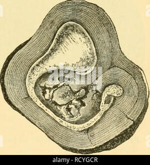 . Die Tiefen des Ozeans: Ein allgemeines Konto der modernen Wissenschaft der Ozeanographie, sich weitgehend auf die wissenschaftlichen Forschungen der Norwegischen Dampfgarer Michael Sars im Nordatlantik. "Michael Sars" North Atlantic Deep-sea Expedition (1910); Ozeanografie ; North Atlantic Ocean. Abb. 128.- Petrous und Membrana Knochen der ziphws Cavirostris. "Challenger" Station 286, Südpazifik, 2335 Klafter. Abb. 129,- Abschnitt eines Mangan-ese Knötchen, zeigen eine Tym-panik Knochen der Mesoplodon in der Mitte. "Challenger" Station 160, südlichen Ozean, 2600 Klafter. Trace grüne Körner ein Stockfoto