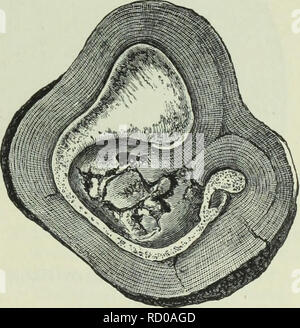 . Die Tiefen des Ozeans; ein allgemeines Konto der modernen Wissenschaft der Ozeanographie, sich weitgehend auf die wissenschaftlichen Forschungen der Norwegischen Dampfgarer Michael Sars im Nordatlantik. Ozeanographie. Abb. 128.- Petrous und Membrana Knochen der zlphivs Cavirostris. "Challenger" Station 286, Südpazifik, 2335 Klafter.. Abb. 129,- Abschnitt eines Mangan-ese Knötchen, zeigen eine Tym-panik Knochen der Mesoplodon in der Mitte. "Challenger" Station 160, südlichen Ozean, 2600 Klafter. Grüne Körner sollen wirft, die verloren haben, alle von der umhüllenden kalkhaltigen Kammern verfolgen. Die in Stockfoto