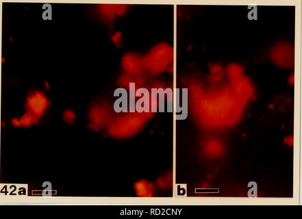 . Zytologische Methoden für die Erkennung, Identifikation und Charakterisierung von orchid Viren und ihre Aufnahme stellen. Orchideen; Virus Krankheiten der Pflanzen. -47-. Abbildung 42 a) und b) CMV-infizierten Phalaenopsis Blütenblatt Zellen mit epifluorescence Optik fotografiert, zeigt die spezifische Fluoreszenz von unregelmäßigen Kristallen behandelt mit TRITC-konjugierten CMV-Antiserum. Bar = 5 Ziel.. Bitte beachten Sie, dass diese Bilder aus gescannten Seite Bilder, die digital für die Lesbarkeit verbessert haben mögen - Färbung und Aussehen dieser Abbildungen können nicht perfekt dem Original ähneln extrahiert werden Stockfoto
