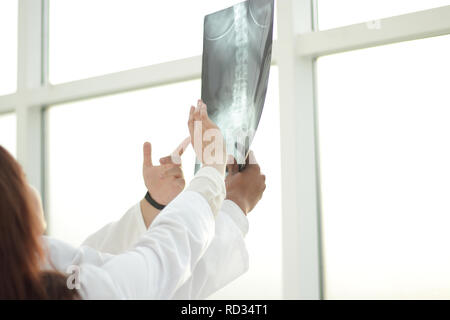 Sind eine Gruppe von Ärztinnen und Ärzten über die Patienten der x-ray. Stockfoto