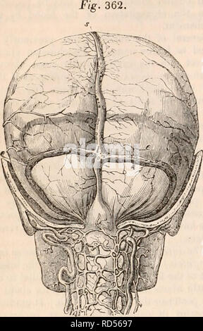 . Die cyclopaedia von Anatomie und Physiologie. Anatomie, Physiologie, Zoologie. 632 NERVENSYSTEM. (Nervöse Zentren. Die MENINGEN.) dinal Sinus oben; eine für die geraden Sinus vor; zwei für die seitenbuchten auf jeder Seite und zwei für den okzipitalen Nebenhöhlen inferiorly (Jig. 362, 0. Hinteren Teil des Schädels entfernt, der Dura mater und die Superior längs zu erzeigen, die seitliche Nebenhöhlen, die ivith torcular Herophili. e, seitliche Sinus; t, torcular Herophili; s, Superior longitudinal Sinus. Seitenbuchten. - Von jeder Seite des Con-Flux der Nasennebenhöhlen, es geht in einem einige-w Stockfoto