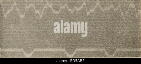 . Elektrophysiologie menschlicher Muskeln. Elektrophysiologie. Abb. 46. Temperatur 7". 15 Hauptwelleu pro Sekunde.. Abb. 47. Temperatur 12". 16 - 18 Hauptwelleu pro Sekunde.. Bitte beachten Sie, dass diese Bilder sind von der gescannten Seite Bilder, die digital für die Lesbarkeit verbessert haben mögen - Färbung und Aussehen dieser Abbildungen können nicht perfekt dem Original ähneln. extrahiert. Pfeifer, Hans Edmund, 1877. Berlin, J. Springer Stockfoto