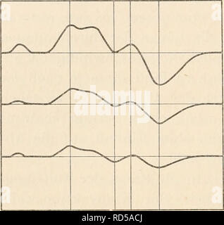 . Elektrophysiologie menschlicher Muskeln. Elektrophysiologie. 42 Über die Fortpflanzungsgeschwindigkeit der Kontraktionswelle. Stanten Wert beibehält, nämlich annähernd^--^^^^^^ Sekunde und daß auch sterben ganze Aktionsstromwelle eine konstante Länge (Dauer) innehält, etwa^/^o Sekunde, ganz gleich-gültig, ob Zuckungen von sehr kleiner oder von Maxi-maler Hubhöhe durch Variierung der Reizstärke erzeugt wurden. Mit der Reizstärke änderte sich nur die Ampli-tude der abgeleiteten und registrierten Stromwelle. Das bedeutet, daß die Fortpflanzungsgeschwindigkeit der Kontraktions-Welle in Abhängi Stockfoto