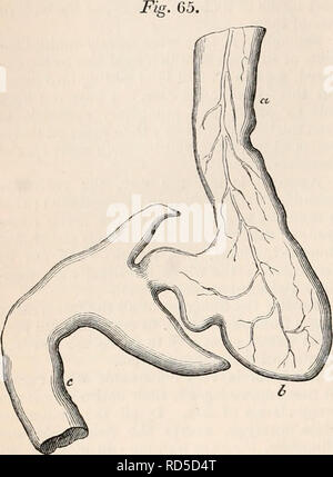 . Die cyclopaedia von Anatomie und Physiologie. Anatomie, Physiologie, Zoologie. 92 BAUCHSPEICHELDRÜSE. Form; sie sind zwei an der Zahl, reichlich, kegelförmige und recurved, zurück, die über die Duo-Denum ganz am Anfang, so dass es zu stacheldraht oder Pfeil-Kopf aussehen, wie in der Zeichnung gesehen (Abb. 65.). Der Magen in dieser Fisch ist sehr klein, und das Duodenum. Pyloric cceca der Steinbutt. a, Speiseröhre; b, Magen; c, Darm. (Gezeichnet ein Drittel der natürlichen Durchmesser.) sehr groß und das Essen wahrscheinlich geht in den Darm mit wenig Verzögerung aber. Die caeca in diesem Fall muss als Exceptio Stockfoto