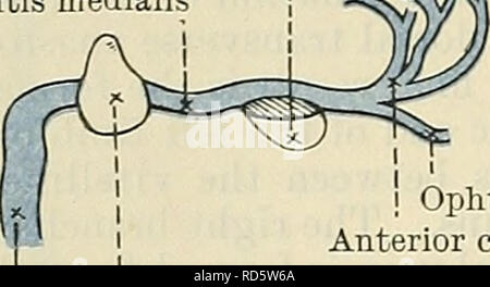 . Cunninghams Lehrbuch der Anatomie. Anatomie. 1038 Die VASCULAE SYSTEM. Letzteres wird der linken Vena advehens, weiterhin bis zur Geburt und, nach dem Verschwinden des Ri°ht seitliche Vena umbilicalis, es vermittelt das Blut aus der Plazenta in die Leber, wo ein Teil der Plazenta Blut strömt in die linke Vena advehens und so durch die linke Vena revehens in die Vena cava inferior, und ein Teil geht in den Ductus venosus, durch die es erreicht, die auf den Teil des Cephalen Teil der rechten Vena advehens, die in die Vena cephalica oder oberen Ende der permanenten Vena cava inferior. Nach der Geburt Stockfoto