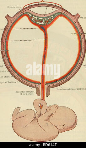 . Cunninghams Lehrbuch der Anatomie. Anatomie. 62 menschliche Embryologie chorion Platte die intervillösen Räume intern schließen; (2) die Zotten; (3) die intervillösen Räume; und (4) die basale Schicht des Trophoblasten, die die intervillösen Räume nach außen geschlossen und ist perforiert, von der mütterlichen Gefäße, die zu und von den Räumen. Die mütterliche Teil der abgeschlossenen Plazenta besteht von Innen nach Außen (1) die Basalschicht der Dezidua; (2) die Überreste der schwammigen Schicht der Dezidua; und (3) Unverändert. Schwammig legen Eigelb sacs Nabelschnur Ektoderm von Amnion abgesicherten mesode Stockfoto