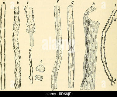 . Cursus der normalen Histologie zur Einführing in den Gebrauch des Mikroskopes, sowie in das practicche Studium der Gewebelehre. Die histologie; Mikroskopie. 198 Sterben einfachen Gewebe. fasciculäre Endoneiirium Bindegewebe oder Bürsten, welches kleinere Bündelchen abtrennt, aber auch zwischen die einzelnen Nerven - Fasern eindringt, Werdener durch Zerzupfen in sterben Nervenfasern zerlegt, welche durchaus mit den Muskelfasern in Parallele gestellt werden können. This Nervenfasern (Abb. 60) zeigen nicht überall, wo sie vorkommen, dieselben Bestandtheile, nur ein bestandtheil ist stets vorhanden und deshalb eine Stockfoto