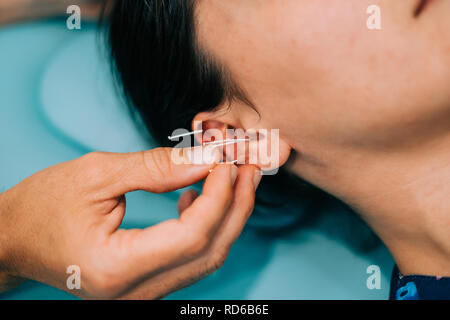 Physiotherapeut, Akupunktur, um eine junge Frau auf Ihr Ohr Stockfoto