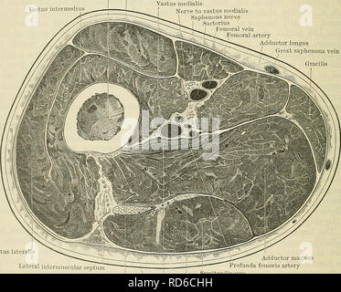 . Cunninghams Lehrbuch der Anatomie. Anatomie. 1456 SUEGICAL SUKFACE UND ANATOMIE. Der Ischiasnerv betritt das Gesäß an einem Punkt an der Kreuzung der oberen und mittleren Drittel einer Linie, die von der überlegenen posterioren Darmbein Wirbelsäule hingewiesen, Ischias tuberosity; ab diesem Zeitpunkt den Nerv geht nach unten und leicht seitlich auf den Gesäßknochen zu einem Punkt in der Mitte zwischen Ihren Ischias Knolle - osity und des Trochanter major. Die Wirbelsäule Der sitzbein und das pudendal Schiffe sind gegenüber der Kreuzung der unteren und mittleren Drittel der Zeile oben liegt. Die Gefäße und Nerven, die e Stockfoto