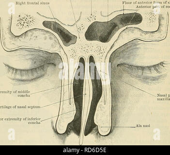 . Cunninghams Lehrbuch der Anatomie. Anatomie. 1372 SUKFACE UND SUEGICAL ANATOMIE. Oder der posterioren Wand. Die rnuco - Periostaler Futter, die leicht Streifen von den Knochen, ist dünn und blass, und mit Schleimhaut-absondernden Drüsen. In vielen Einzelpersonen, die durch die Beihilfe von Trans-Beleuchtung, den Umfang der Kurven und die Position des eingreifenden Septum kann auf die Stirn abgebildet werden. Für diese Crista Galli Septum Rechts frontal Sinus frontalis Links frontalis Boden der vorderen Schädelgrube des Schädels vorderen Teil des Dachs der Orbit. Vordere Extremität des mittleren concha Knorpel von Nasalen se Stockfoto