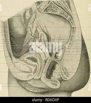 . Cunninghams Lehrbuch der Anatomie. Anatomie. 1310 Die GEXITAL UEIXO-SYSTEM. Die WEIBLICHEN GESCHLECHTSORGANE. Die keimdrüsen in der weiblichen sind ein paar Eierstöcke seitlich in den Hohlraum des Beckens gelegt. In Verbindung mit jedem Fruchtknoten ist eine längliche Passage oder Röhre der Tuba uterina, Gebärmutter oder Eileiter, der Gebärmutter führt und öffnet in die Vertiefung. Es gibt keinen direkten Durchgang zwischen der Eierstöcke und der Gebärmutter Rohr, wie zwischen den anderen Drüsen des Körpers und ihre Kanäle vorhanden, aber, wenn die Eizellen aus dem Eierstock, Pass in das offene Ende des Rohrs vergossen, und sind somit Stockfoto