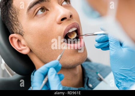 Nahaufnahme der afrikanischen amerikanischen Mann mit offenen Mund während der Untersuchung in der zahnmedizinischen Klinik Stockfoto