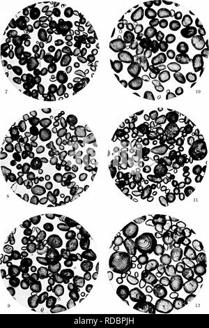. A biochemic Basis für das Studium der Taxonomie, Vererbung, Evolution, etc., mit besonderer Bezugnahme auf die Stärke und das Gewebe des Elternteils - Aktien und Hybrid-Bestände und die Stärke und hämoglobine von Sorten, Arten und Gattungen. Stärke; Biochemie; Pflanzen-hybriden; Pflanzen. Platte 2. 7. Hippeastrum Titan. 8. Hippeastrum cleonia. 9. Hippeastrum iitan - cleonia. 10. Hippeastrum ossultan. 11. Hippeastrum pyrrha. 12. Hippeastrum ossultan - pyrrha.. Bitte beachten Sie, dass diese Bilder aus gescannten Seite Bilder, die digital für die Lesbarkeit verbessert haben mögen - Färbung und extrahiert werden Stockfoto
