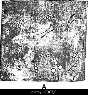 . Fossile Pflanzen: für Studenten der Botanik und Geologie. Paläobotanik. VIl] Bazillen. 135 wurden minutiös diagnostiziert und durch Profs herausgefunden. Renault und Bertrand". Diese Autoren haben entdeckt, was sie glauben, gut definiert werden Arten von Micrococcus und Bacillus im Alter von Devon zu Jura. Das Material, das die etwas überraschende Ergebnisse ihrer Untersuchungen besteht teilweise aus den koprolithen von Reptilien und Fische gegeben hat, und der Verkieselten und verkalkte pflanzlichen Geweben. Bazillus Permicus. Ren. und Bert.^ (Abb. 28 B.) dieses Bazillus, die in Abschnitten von ein P entdeckt wurde Stockfoto