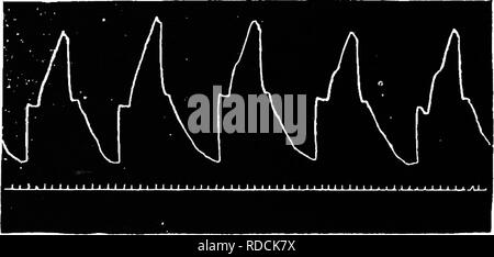 . Klinische Diagnostik der inneren Krankheiten der Haustiere. Veterinärmedizin; Diagnose, Veterinär; Veterinärmedizin. Exspiratorischer Dyspnoe bei Emphysem Pulmonum. Abb. 28 d.. Inspiratorischer und exspiratorischer Dyspnoe bei Entzündung der Lunge oder Brust- Wand. Bitte beachten Sie, dass diese Bilder sind von der gescannten Seite Bilder, die digital für die Lesbarkeit verbessert haben mögen - Färbung und Aussehen dieser Abbildungen können nicht perfekt dem Original ähneln. extrahiert. Malkmus, Bernhard, 1859-1925. Chicago, A. Eger Stockfoto