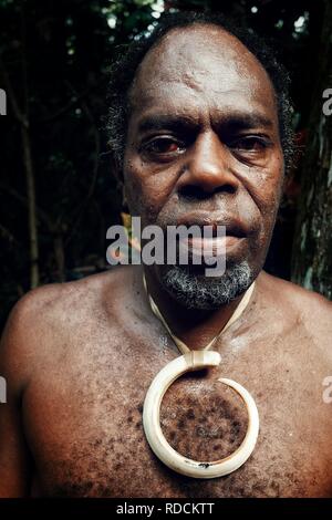 Olal, Ambrym Insel/Vanuatu - JUL 10 2016: Dorf chief mit großen Schwein tusk Schmuck und tief rote Augen Stockfoto