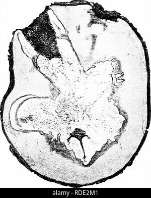 . Krankheiten der Pflanzen. Pflanzenkrankheiten. Abb. 178. - Fomes igniarius auf Ahorn. Nach von Schrenk.. Bitte beachten Sie, dass diese Bilder sind von der gescannten Seite Bilder, die digital für die Lesbarkeit verbessert haben mögen - Färbung und Aussehen dieser Abbildungen können nicht perfekt dem Original ähneln. extrahiert. Stevens, Frank Lincoln, 1871-1934; Hall, John Galentine, 1870 -. New York: Macmillan Stockfoto