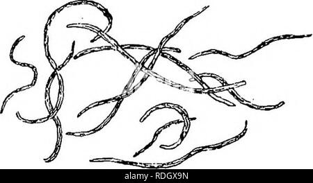 . Die Krankheiten von Kulturpflanzen und deren Abhilfe: ein Handbuch der wirtschaftlichen Biologie für Landwirte und Studenten. Pflanzenkrankheiten. Hülsenfrüchte CBOPS. 17 Die Blätter der Klee Pflanzen. Sie werden voll und ganz unter dem Motto "Pea Rüsselkäfer." Die Clover Eelworms {Tylpnchus devastatrix und Tylenchus Havensteinii, Bild beschrieben werden. 4)^Aw eine der Ursachen, wenn nicht die Ursache, von "clover Krankheit." "Sie zu einer Gruppe von nematoids oder "thread-Würmer", bekannt als die AnguilluUdcB gehören. Drs. J. Kiihn (Biederviann der Zentralen - Mattes Fell Agricultur-Chemie, 1882, S. 270), Havenstein, Taschenberg und andere Stockfoto