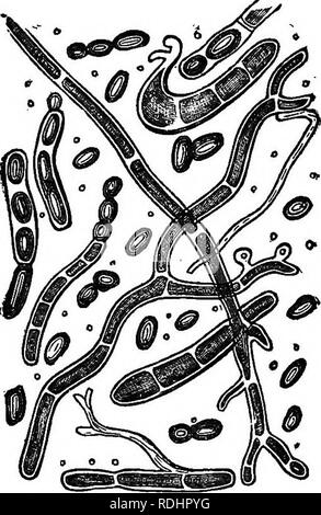 . Tierische und pflanzliche Parasiten der menschlichen Haut und Haar. Medizinische Parasitologie. 58 pflanzliche Parasiten zu erläutern, wie und warum pflanzliche Organismen Pflanze, und auf und in der Haut und Hautanhangsgebilde wachsen. An erster Stelle, wo diese mikroskopischen Bild tun. 8.. Zeigt die Art der Fortpflanzung von tlie acliorion. - Bennett. Sporen oder Samen der Pilze kommen aus? Die Welt ist voll von Thein. Sie sind in allen pflanzlichen Form anwesend und sind überall in der Luft und Wasser durchgeführt. Der Staub von unserem Fenster - Scheiben wird sie unter dem Mikroskop zeigen. Die Luft, die wir atmen, enthält. Es ist wit Stockfoto