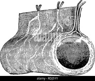 . Ein text-Buch im allgemeinen Physiologie und Anatomie. Physiologie, Vergleichende; Anatomie. 110 Verdauung Stein in der Schleuder. (Siehe Abb. 34.) Die gesamte mem-brane wird durch eine wässrige Flüssigkeit oder Serum geschmiert und. Abb. 34 - Darm durch eine Falte des Peritoneums (mesenterium), die Methode der Eingang von Blutgefäßen unterstützt. Aus diesem Grund ist eine seröse Membran genannt wird. Es ist auch reich mit Blutgefäßen versorgt. Die Organe - Sup. Bitte beachten Sie, dass diese Bilder aus gescannten Seite Bilder, die digital für die Lesbarkeit verbessert haben mögen - Färbung und Aussehen dieser Abbildung extrahiert werden Stockfoto