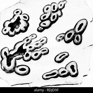 . Eine Monographie der Flechten in Großbritannien gefunden, wird ein Beschreibender Katalog der Arten im Herbarium des British Museum. Flechten. Platte 59 1 - â"^^. ----- '-'. '&Gt; X io. Bitte beachten Sie, dass diese Bilder sind von der gescannten Seite Bilder, die digital für die Lesbarkeit verbessert haben mögen - Färbung und Aussehen dieser Abbildungen können nicht perfekt dem Original ähneln. extrahiert. British Museum (Natural History). Lehrstuhl für Botanik; Crombie, James Morrison, 1833-1906; Smith, Annie Lorrain, 1854-1937. London, Gedruckt im Auftrag des Kuratoriums Stockfoto