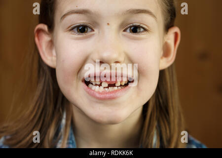 Kleines Mädchen lächelnd, zeigt ihre fehlende Milchzähne. Verspielte, fröhliche Kindheit, Zahnfee, Wachstum und Meilenstein Konzept. Stockfoto