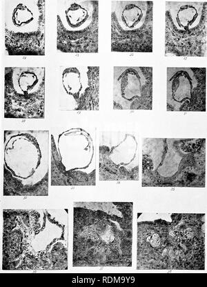 . Markieren Jahrestag Volumen; Edward Laurens Mark, Hersey Professor für Anatomie und Direktor des Zoo? logische Labor an der Harvard University, in der Feier von 25 Jahren erfolgreicher Arbeit für die Weiterentwicklung der Zoo?. Mark, E.L. (Edward Laurens), 1847-1946; Zoologie; Anatomie, Vergleichende; Physiologie; Embryologie. Markieren Jubiläumsband. Platte XXXI. LEE - Spebmophilus II. Bitte beachten Sie, dass diese Bilder aus gescannten Seite Bilder, die digital für die Lesbarkeit verbessert haben mögen - Färbung und Aussehen dieser Abbildungen können nicht genau mit dem beschäftigungsprojekt ähneln extrahiert werden Stockfoto