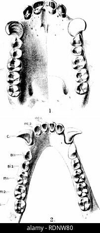 . Wissenschaft von einem Sessel; eine zweite Reihe. Wissenschaft; Natural History. I ATE VIII. Zähne des Ober- und des Unterkiefers des Gibbon.. Bitte beachten Sie, dass diese Bilder sind von der gescannten Seite Bilder, die digital für die Lesbarkeit verbessert haben mögen - Färbung und Aussehen dieser Abbildungen können nicht perfekt dem Original ähneln. extrahiert. Lankester, Edwin E. Ray (Ray), Sir, 1847-1929. London, Methuen Stockfoto