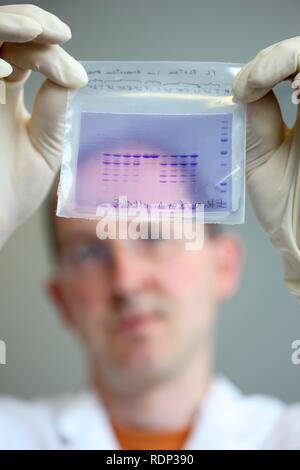 Biotechnologie Labor, Protein gel Analyse, Zentrum für Medizinische Biotechnologie Universität Duisburg-Essen Stockfoto