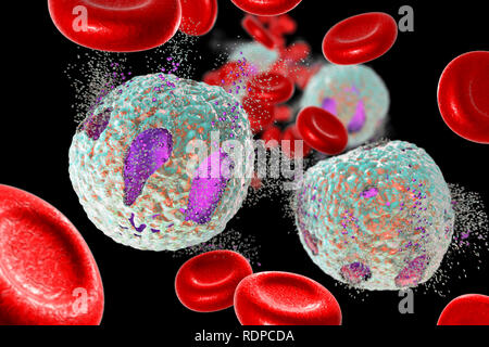 Akute lymphoblastische Leukämie Behandlungskonzept. Computer Abbildung: Zerstörung von Lymphoblast Zellen. Stockfoto