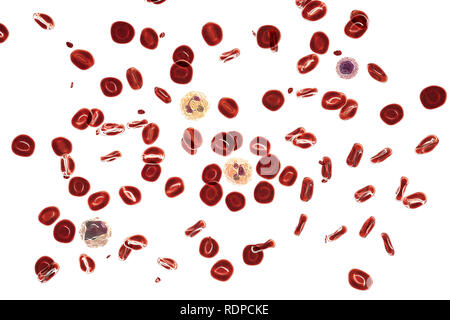 Normalen Blutausstrich. Computer Abbildung: rote Blutkörperchen, Blutplättchen (kleine rote Teilchen), neutrophilen Granulozyten (weiße Blutkörperchen in der Mitte und eine andere nach unten rechts), Monozyten (links unten) und Lymphozyten (oben rechts). Stockfoto