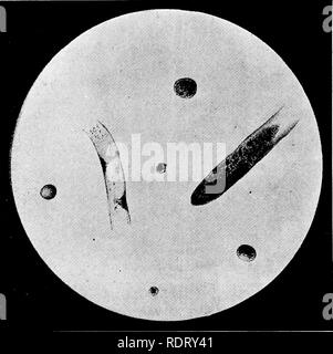 . Elemente der angewandten Mikroskopie. Ein text-Buch für Anfänger. Mikroskopie. Keine ELEMENTE DER ANGEWANDTEN MIKROSKOPIE. am Ohr durch das Stechen mit einem sterilen Lance oder Glover Nadel nach sorgfältig waschen, die Oberfläche der Haut. Einen kleinen Tropfen sollte auf die Kante eines sauberen Objektträger, die gefangen werden. Abb. 43.- der Harnwege Sediment in der akuten Helle Krankheit. (Granu-lar wirft, Leukozyten und Epithelzellen.) (nach Ultzmann und Hofmann.) 200 Durchmesser. wird dann in Kontakt mit der Oberfläche eines zweiten sauberen Folie gebracht. Das obere Glas ist entlang der unteren in einem spitzen Winkel, so dass das Blut-drop Austritt b Stockfoto