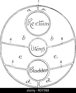. Die Anatomie der Haustiere. Veterinär Anatomie. Abb. . 352. - Schematische Querschnitt zu zeigen Ar-Abb. 353,- Schematischer Querschnitt zu zeigen Ar-R. ANGEMENT der Becken- bauchfell im Mann. Abmachung der Becken- bauchfell IM weiblichen. a, b, Recto-genitalen Tasche; c, c, Vesiko-genitalen Tasche; d, d, vcsico - pubic Tasche; 1, mesorectum; 2, 2, genitale Falten in den männlichen, breiten Bänder der Gebärmutter bei weiblichen; 3, 3, seitliche Bänder der Blase; 4, Mitte ligament der Blase; v. d., Ductus deferentes; u. m., der Gebärmutter mascuUnus., Menge der subserous und retroperitoneale Fett an den Wänden gefunden wird und ich Stockfoto