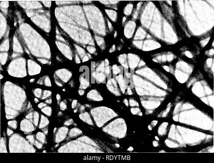 . Grundsätze der modernen Biologie. Biologie. 324-Vielzellige Tiere, vor allem Mann ich. Abb. 17-6. Zarte Netzwerk von fibrin Fasern abgelagert, nachdem Thrombin (Thrombose) hat zu einer Fibrinogen Lösung hinzugefügt. Ein ähnliches Netzwerk, in der Regel gelierende Vollblut gebildet, enmeshes der ADR-puscles und flüssigen Komponenten und bietet Der thrombus oder Blutgerinnsel, mit einem erheblichen Maß an Solidität. Die Vergrößerung in Dieser electronmicrograph ist 30.000 Durchmesser. (Mit freundlicher Genehmigung von Clinton Van Zandt Hawn, Keith R. Porter, die Rockefeller Institut für medizinische Forschung). Takt mit einem beschädigten Gewebe, li Stockfoto