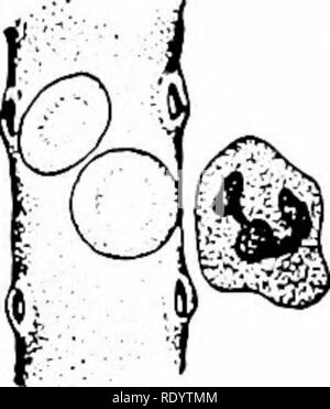 . Grundsätze der modernen Biologie. Biologie. Abb. 17-4. Leukozytäre diapedesis durchführen, die auch Aktiv sichern sich die Wand eines Kapillarblut Gefäß, und Phagozytose, durch die es verschlingt Bakterien in das Gewebe. Semidiagrammatic. Wenn diese Parasiten verwalten Die tis-nent von pus einzugeben, wie es sammelt sich an der Infektion - klagt über eine offene Wunde. Die leukozyten. Neben der zu verdauen, die Bakterien in die Wunde migrieren, vorübergehende und anderen Fremdkörpern Sie phagozytose haben - durch die Wände der Kapillaren im cytized, die Leukozyten sezernieren Enzyme extra Stockfoto